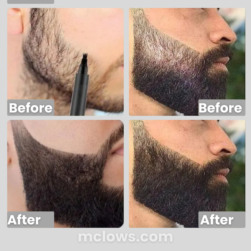 Beard Filler