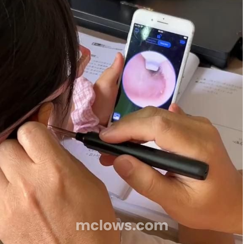 Ear Cleaning Tool